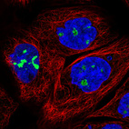 Anti-NOP56 Antibody