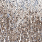 Immunohistochemical staining of human adrenal gland shows strong cytoplasmic positivity in glandular cells.