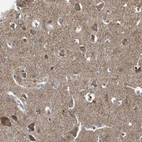 Immunohistochemical staining of human cerebral cortex shows strong cytoplasmic positivity in neurons.