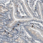 Immunohistochemical staining of human small intestine shows strong cytoplasmic positivity in enteroendocrine cells.