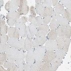 Immunohistochemical staining of human skeletal muscle shows no positivity in myocytes as expected.