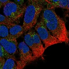 Immunofluorescent staining of human cell line AF22 shows localization to vesicles.