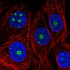Immunofluorescence staining in MCF7 cell line with Anti-NOP56 monoclonal antibody, showing nucleoli-specific staining in green. Microtubule- and nuclear probes are visualized in red and blue respectively (where available).
