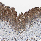 Immunohistochemical staining of human urinary bladder shows strong cytoplasmic positivity in glandular cells.