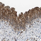 Immunohistochemical staining of human urinary bladder shows strong cytoplasmic positivity in glandular cells.