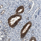 Immunohistochemical staining of human endometrium shows strong cytoplasmic positivity in glandular cells.