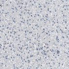 Immunohistochemical staining of human liver shows no positivity in hepatocytes as expected.