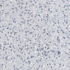 Immunohistochemical staining of human liver shows no positivity in hepatocytes as expected.
