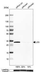 Western blot analysis in MCF-7 cells transfected with control siRNA, target specific siRNA probe #1 and #2, using Anti-LXN antibody. Remaining relative intensity is presented. Loading control: Anti-GAPDH.