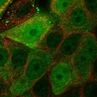 Immunofluorescent staining of human cell line MCF7 shows localization to nucleoplasm & cytosol.