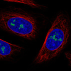 Anti-NOP56 Antibody