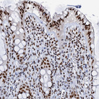 Immunohistochemical staining of human rectum shows strong nuclear positivity in glandular cells.