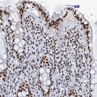 Immunohistochemical staining of human rectum shows strong nuclear positivity in glandular cells.