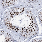 Immunohistochemical staining of human testis shows strong nuclear positivity in cells in seminiferous ducts.