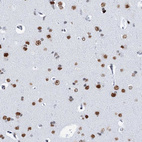 Immunohistochemical staining of human cerebral cortex shows strong nuclear positivity in neurons.