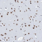 Immunohistochemical staining of human cerebral cortex shows strong nuclear positivity in neurons.