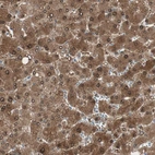 Immunohistochemical staining of human liver shows strong cytoplasmic positivity in hepatocytes.