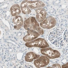 Immunohistochemical staining of human kidney shows strong cytoplasmic positivity in cells in proximal tubules.