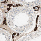 Immunohistochemical staining of human testis shows strong cytoplasmic positivity in Leydig cells.