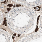 Immunohistochemical staining of human testis shows strong cytoplasmic positivity in Leydig cells.