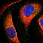 Immunofluorescent staining of human cell line U-2 OS shows localization to plasma membrane & vesicles.