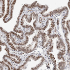 Immunohistochemical staining of human fallopian tube shows strong nuclear positivity in glandular cells.