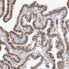 Immunohistochemical staining of human fallopian tube shows strong nuclear positivity in glandular cells.