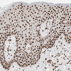 Immunohistochemical staining of human skin shows strong nuclear positivity in squamous epithelial cells.