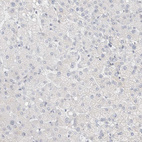 Immunohistochemical staining of human liver shows no positivity in hepatocytes as expected.