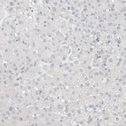 Immunohistochemical staining of human liver shows no positivity in hepatocytes as expected.