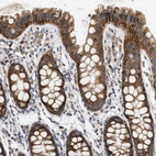 Immunohistochemical staining of human colon shows strong granular cytoplasmic positivity in glandular cells.