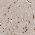 Immunohistochemical staining of human hippocampus shows moderate to strong granular cytoplasmic positivity in neurons.