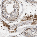 Immunohistochemical staining of human testis shows strong granular cytoplasmic positivity in cells in seminiferous ducts.