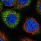 Immunofluorescent staining of human cell line A-431 shows localization to cytosol.