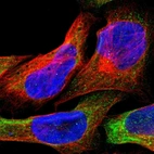 Immunofluorescent staining of human cell line U-2 OS shows positivity in cytoplasm.