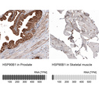 Anti-HSP90B1 Antibody