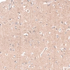 Immunohistochemical staining of human cerebral cortex shows moderate positivity in neuronal processes in neuropil.