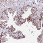 Immunohistochemical staining of human prostate shows moderate granular cytoplasmic positivity in glandular cells.
