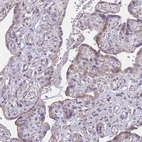 Immunohistochemical staining of human placenta shows weak granular cytoplasmic positivity in trophoblastic cells.