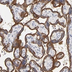 Immunohistochemical staining of human placenta shows strong membranous positivity in trophoblastic cells.