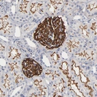Immunohistochemical staining of human kidney shows strong membranous positivity in cells in glomeruli.