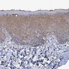 Immunohistochemical staining of human skin shows strong membranous and cytoplasmic positivity in squamous epithelial cells.