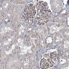 Immunohistochemical staining of human kidney shows strong membranous positivity in cells in glomeruli.