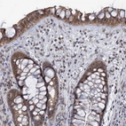 Immunohistochemical staining of human rectum shows strong cytoplasmic positivity in glandular cells.
