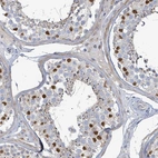 Immunohistochemical staining of human testis shows strong nuclear positivity in spermatocytes.