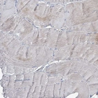 Immunohistochemical staining of human skeletal muscle shows no positivity in myocytes as expected.