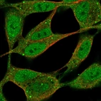 Immunofluorescent staining of human cell line SH-SY5Y shows localization to nucleoplasm, cytosol & vesicles.