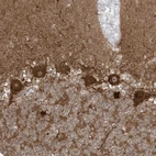 Immunohistochemical staining of human cerebellum shows strong cytoplasmic positivity in Purkinje cells.