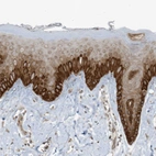 Immunohistochemical staining of human skin shows strong cytoplasmic positivity in squamous epithelial cells.