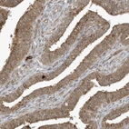 Immunohistochemical staining of human fallopian tube shows moderate cytoplasmic positivity in glandular cells.